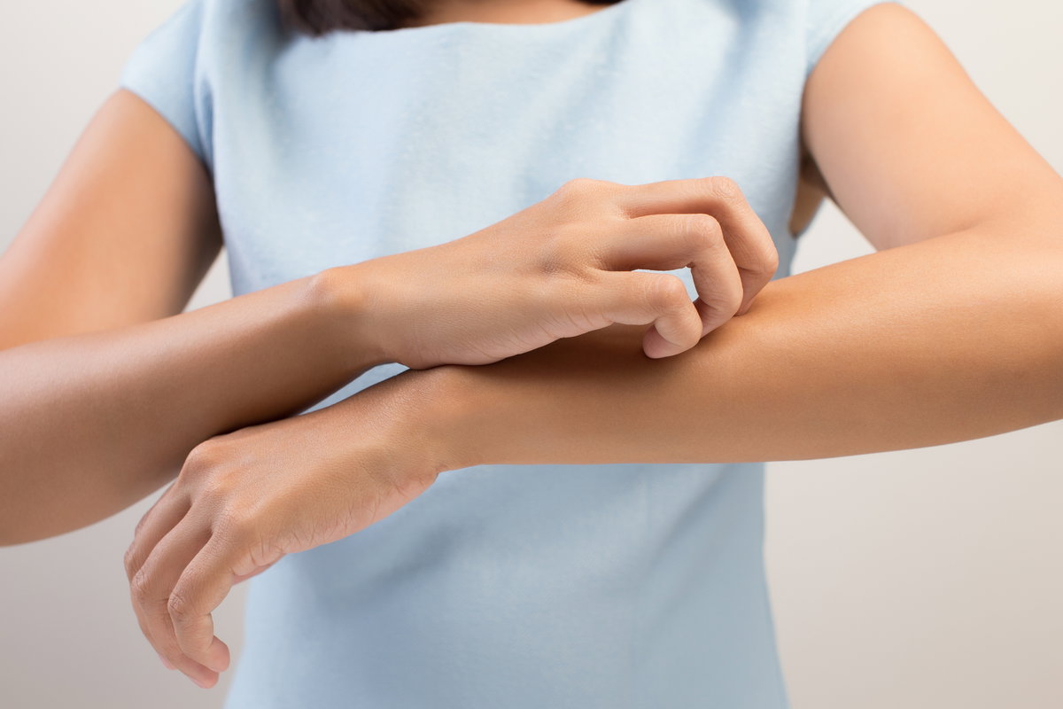 Frau kratzt sich am Arm