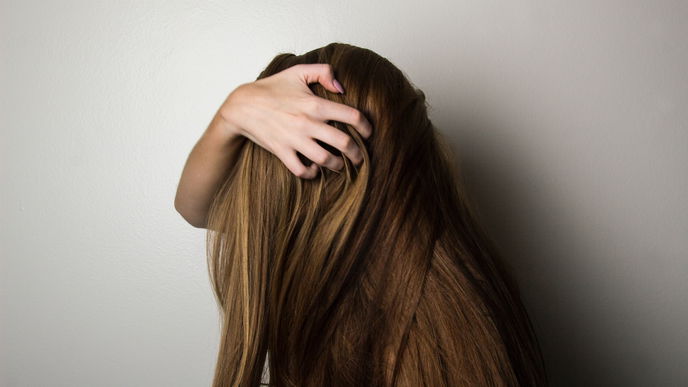 Kreisrunder Haarausfall: Die Ursachen von Alopecia areata