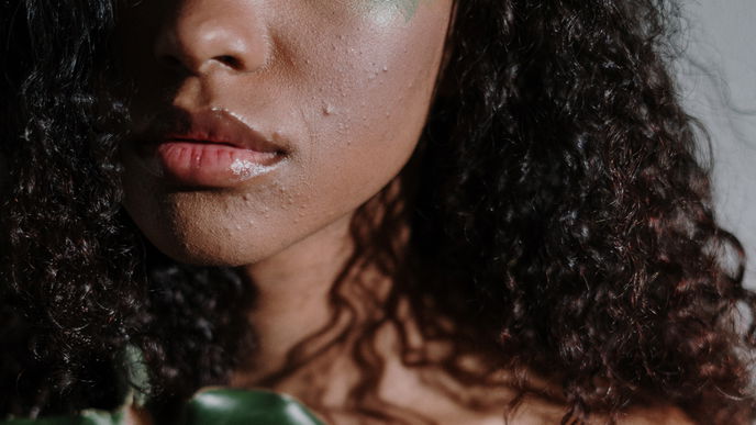 4 Beauty-Produkte helfen gegen Pickel