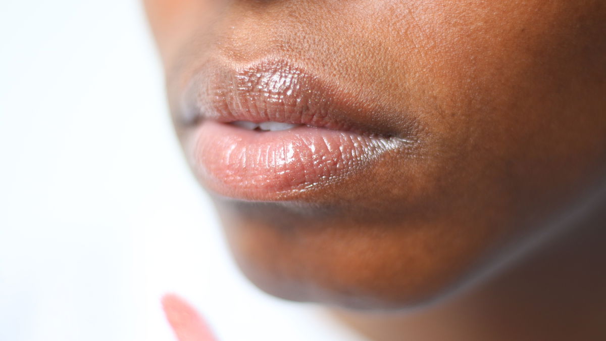 Sonnenbrand auf Lippen: Diese Tipps helfen