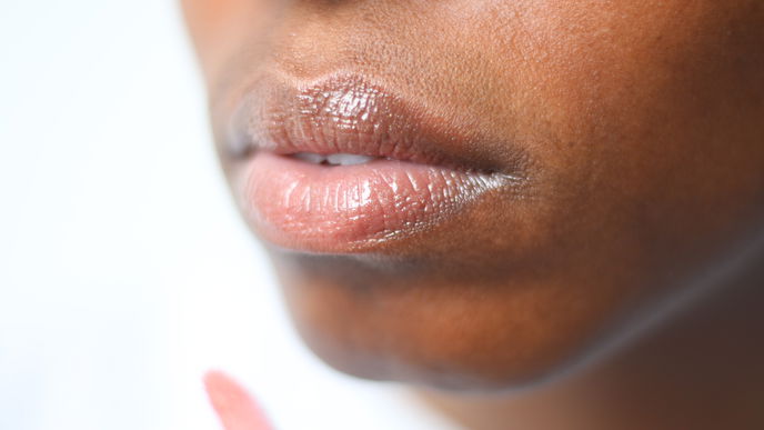 Sonnenbrand auf Lippen: Diese Tipps helfen