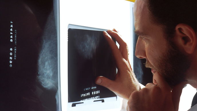 Prostatakrebs: Darum sollten alle Männer zur Vorsorge gehen