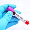 Ab dem 23. September: BRCA Awareness Week 2024 will das Brustkrebsrisiko senken