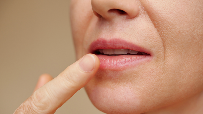 Trockene Lippen? Diese 5 Hausmittel machen die Haut sofort streichelzart und weich