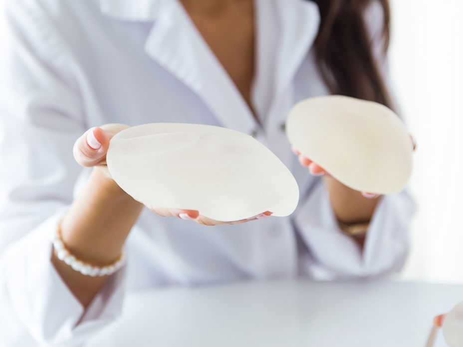 Eine Frau hält Implantate in der Hand