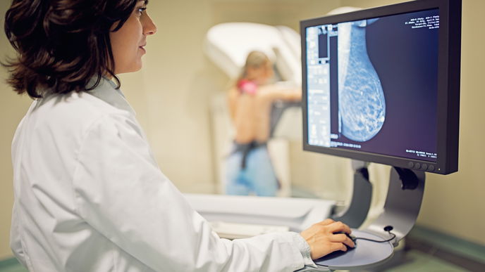 Brustkrebs-Früherkennung 2025: Mammographie ab 45, mehr Medikamente und der Einsatz von KI – was die Forschung jetzt verändert