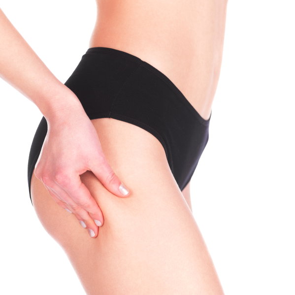 Tipps gegen Cellulite