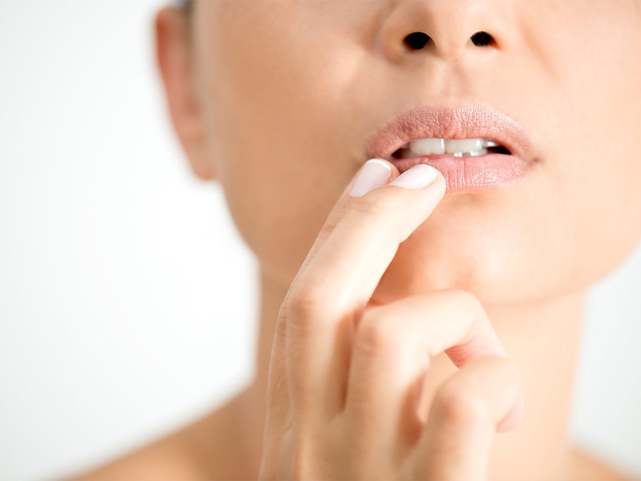 Homöopathische Mittel gegen Herpes