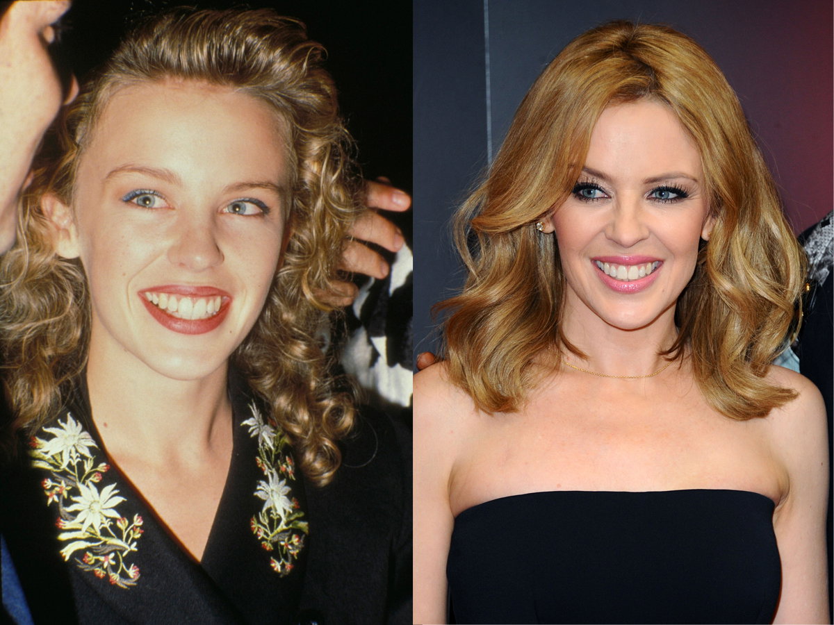 Kylie Minogue